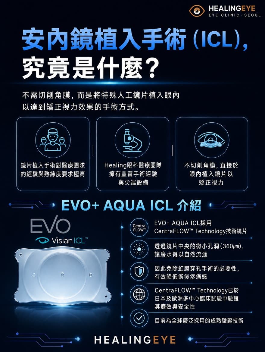 植入式微型鏡片 (ICL) — 2