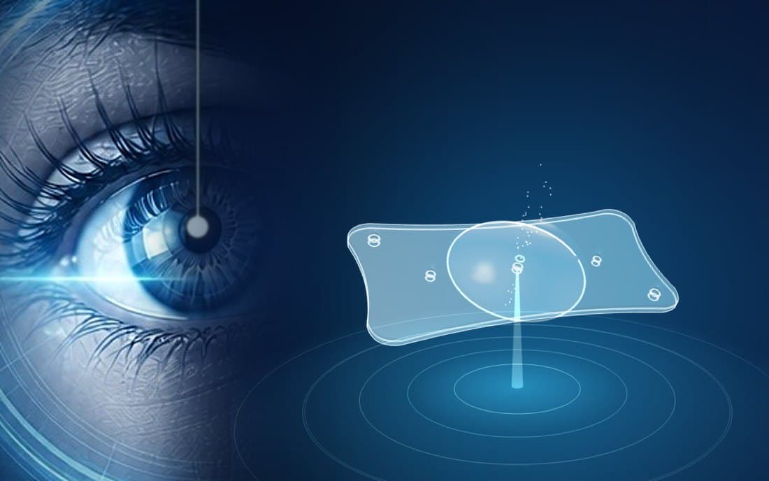 Implantable Lens (ICL)