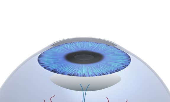 Illustration of an eye showing the blue iris with the clear natural lens sitting just behind it